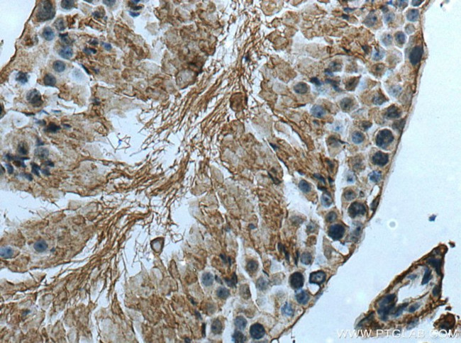 ACE2 Antibody in Immunohistochemistry (Paraffin) (IHC (P))