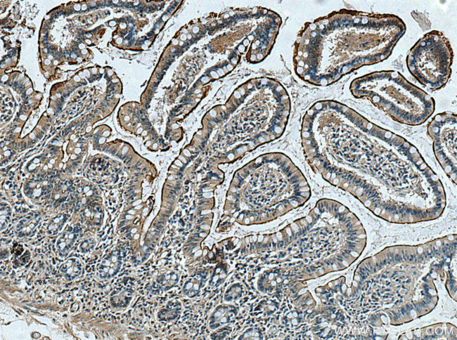 ACE2 Antibody in Immunohistochemistry (Paraffin) (IHC (P))