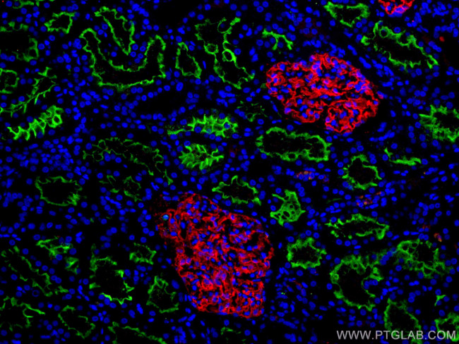 ACE2 Antibody in Immunohistochemistry (PFA fixed) (IHC (PFA))