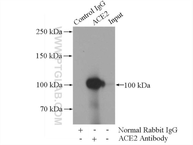 ACE2 Antibody in Immunoprecipitation (IP)