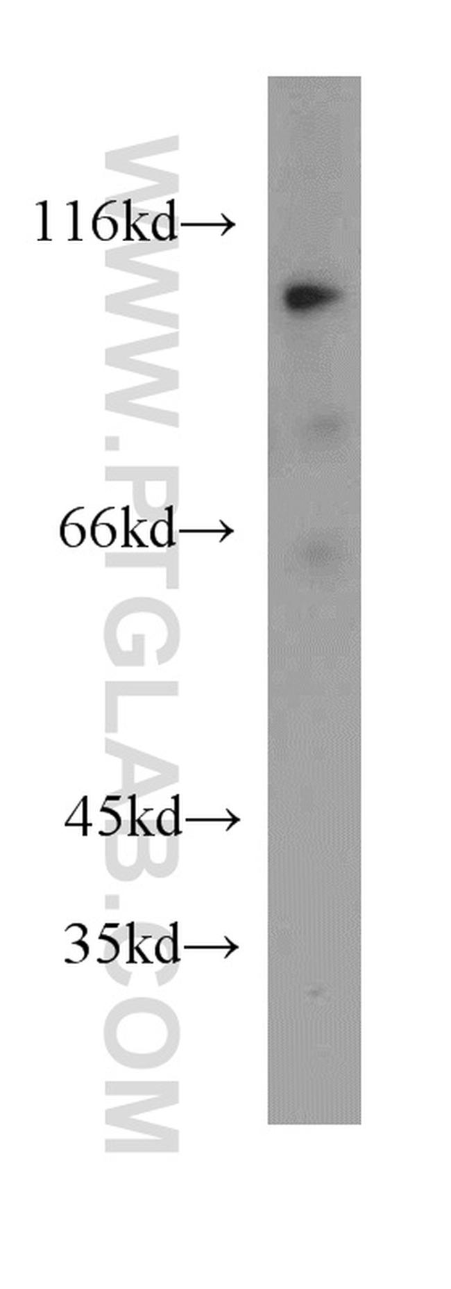 ACE2 Antibody in Western Blot (WB)