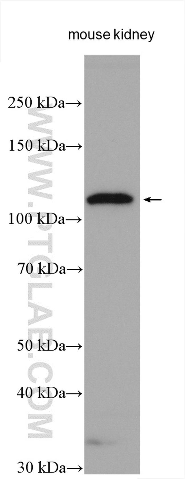 ACE2 Antibody in Western Blot (WB)