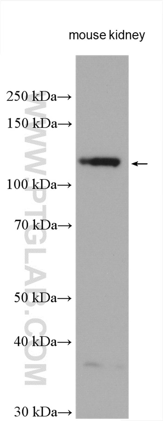 ACE2 Antibody in Western Blot (WB)