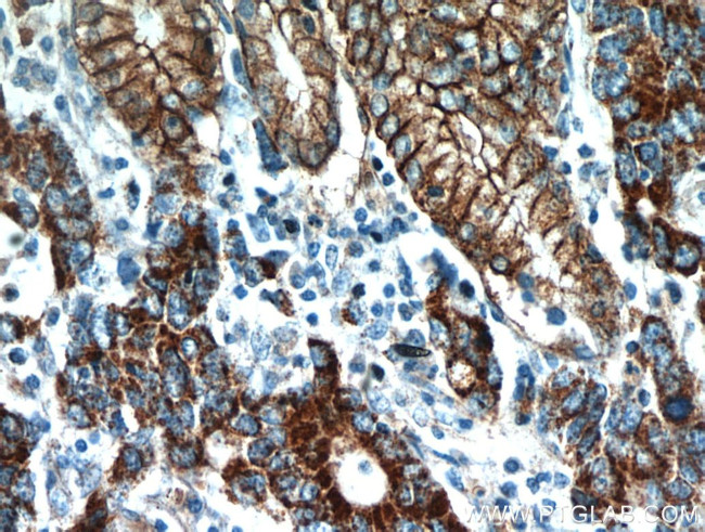 Claudin 18 Antibody in Immunohistochemistry (Paraffin) (IHC (P))