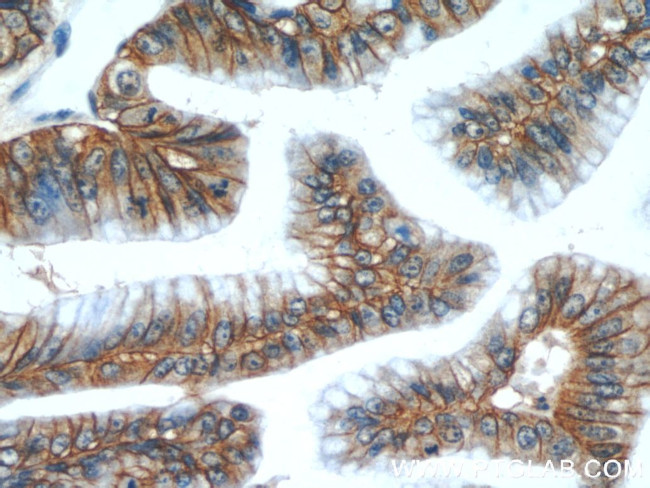 Claudin 18 Antibody in Immunohistochemistry (Paraffin) (IHC (P))