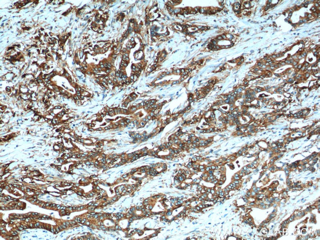 Claudin 18 Antibody in Immunohistochemistry (Paraffin) (IHC (P))