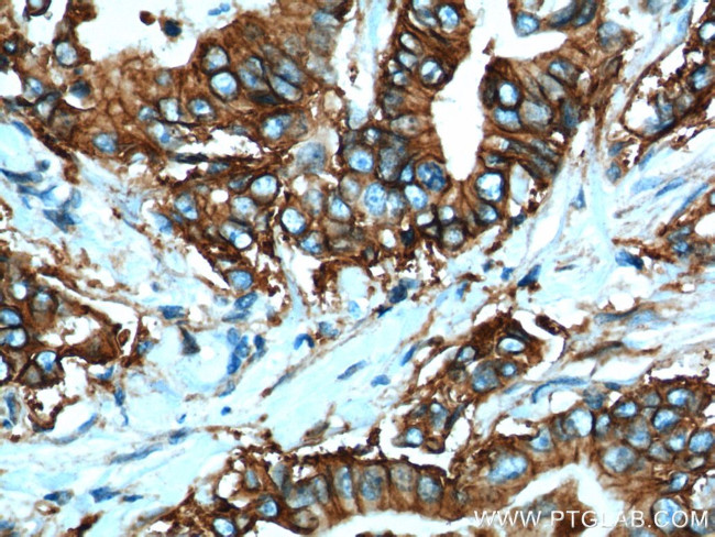 Claudin 18 Antibody in Immunohistochemistry (Paraffin) (IHC (P))