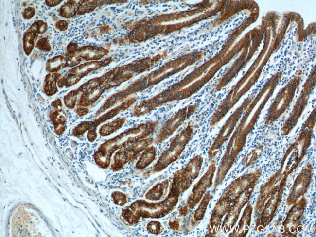 Claudin 18 Antibody in Immunohistochemistry (Paraffin) (IHC (P))