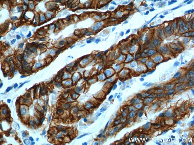 Claudin 18 Antibody in Immunohistochemistry (Paraffin) (IHC (P))