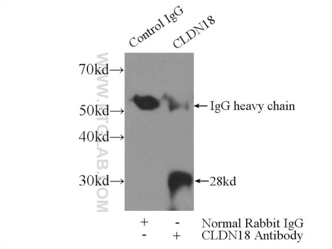 Claudin 18 Antibody in Immunoprecipitation (IP)