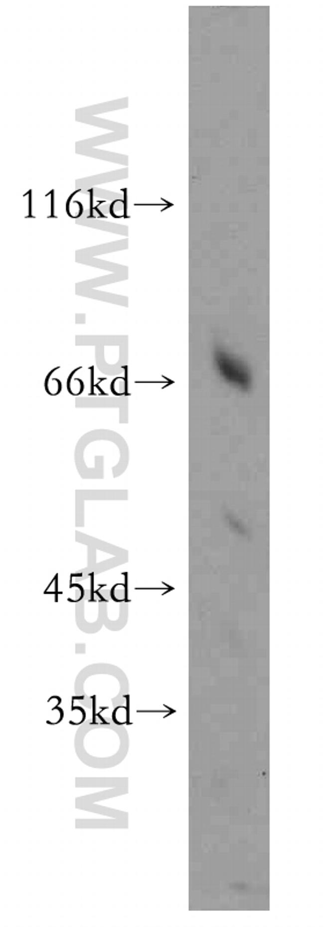 HPSE2 Antibody in Western Blot (WB)