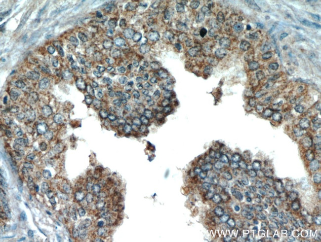 KIAA1199 Antibody in Immunohistochemistry (Paraffin) (IHC (P))