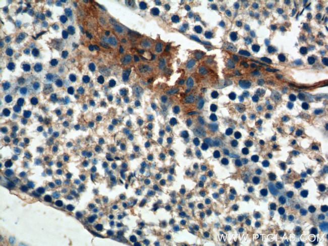 KIAA1199 Antibody in Immunohistochemistry (Paraffin) (IHC (P))