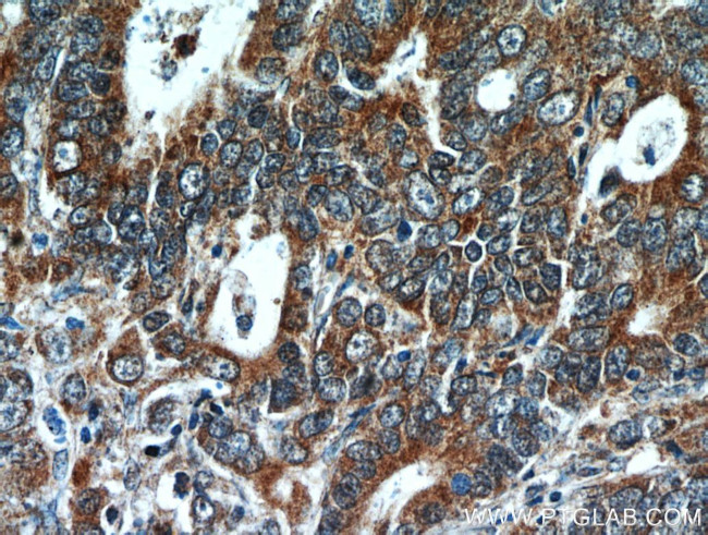 KIAA1199 Antibody in Immunohistochemistry (Paraffin) (IHC (P))