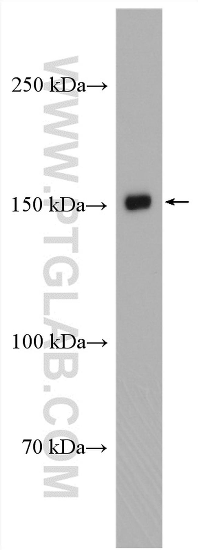 KIAA1199 Antibody in Western Blot (WB)