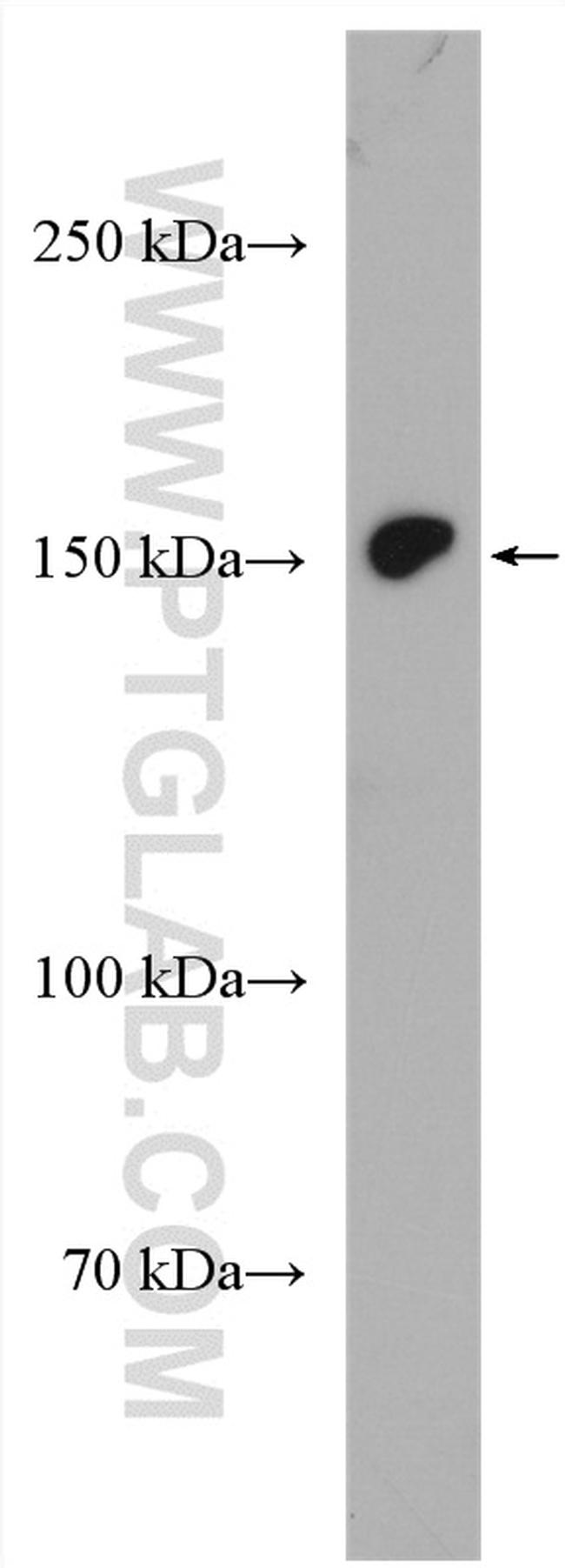 KIAA1199 Antibody in Western Blot (WB)