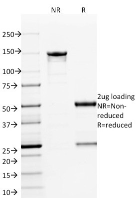 ETS1 (Marker of Tumor Metastasis) Antibody in SDS-PAGE (SDS-PAGE)