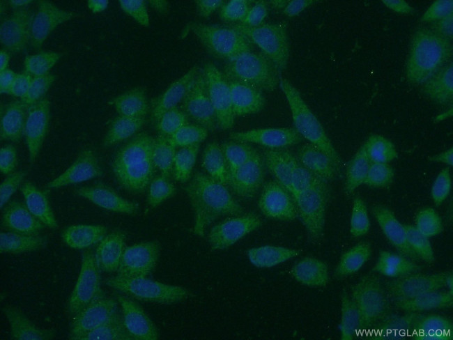 MAN2A1 Antibody in Immunocytochemistry (ICC/IF)