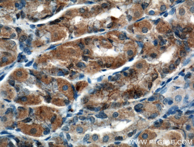 MAN2A1 Antibody in Immunohistochemistry (Paraffin) (IHC (P))