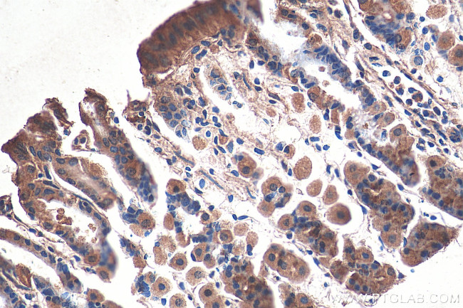 MAN2A1 Antibody in Immunohistochemistry (Paraffin) (IHC (P))