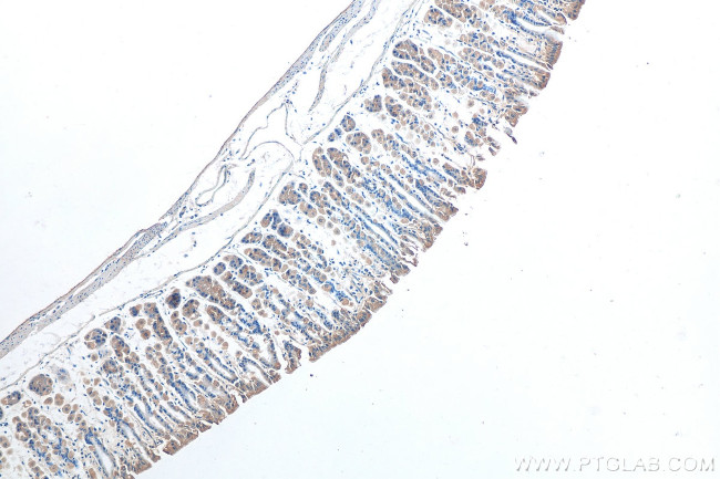 MAN2A1 Antibody in Immunohistochemistry (Paraffin) (IHC (P))