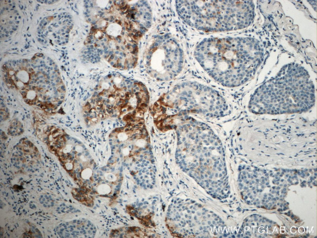 LIPC Antibody in Immunohistochemistry (Paraffin) (IHC (P))