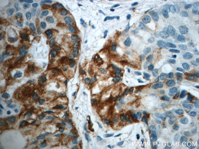 LIPC Antibody in Immunohistochemistry (Paraffin) (IHC (P))