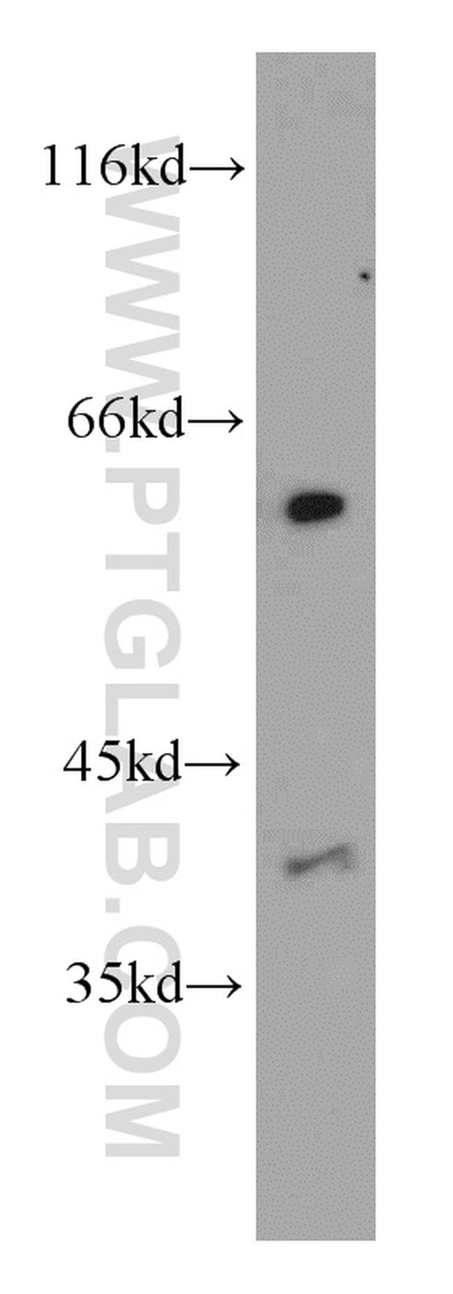 LIPC Antibody in Western Blot (WB)