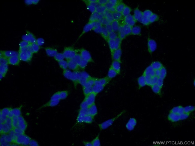 SPACA3 Antibody in Immunocytochemistry (ICC/IF)