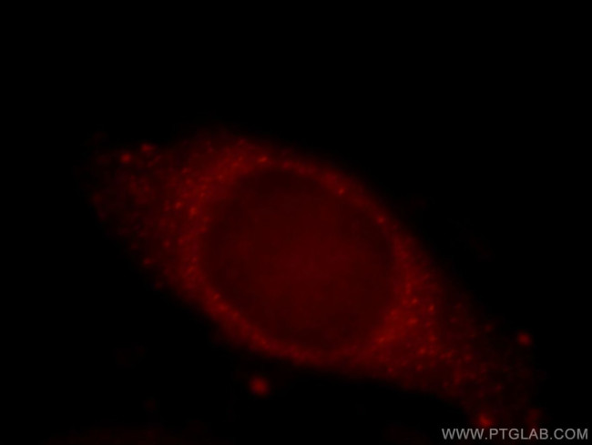 KIAA0528 Antibody in Immunocytochemistry (ICC/IF)