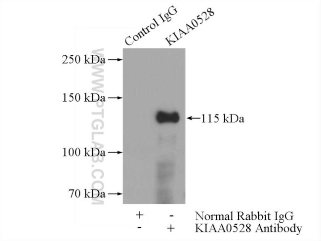 KIAA0528 Antibody in Immunoprecipitation (IP)