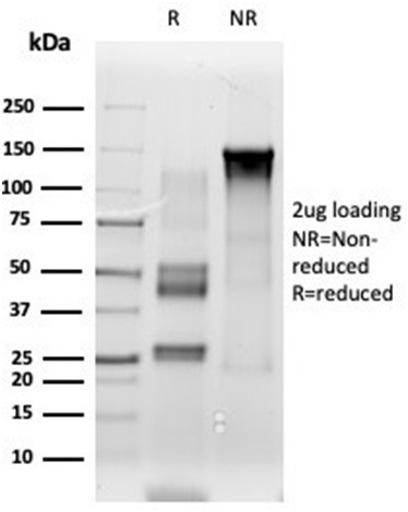 ETS2 (Transcription Factor) Antibody in SDS-PAGE (SDS-PAGE)