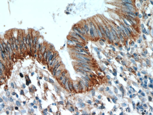 LARS Antibody in Immunohistochemistry (Paraffin) (IHC (P))