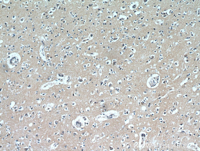 LARS Antibody in Immunohistochemistry (Paraffin) (IHC (P))