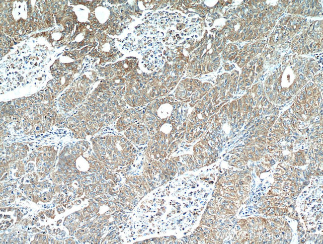 LARS Antibody in Immunohistochemistry (Paraffin) (IHC (P))