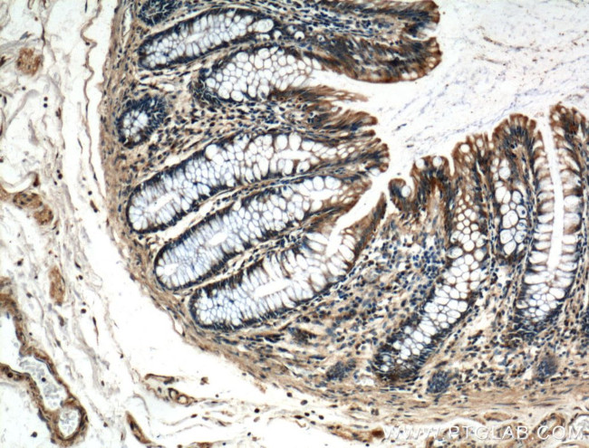 LARS Antibody in Immunohistochemistry (Paraffin) (IHC (P))