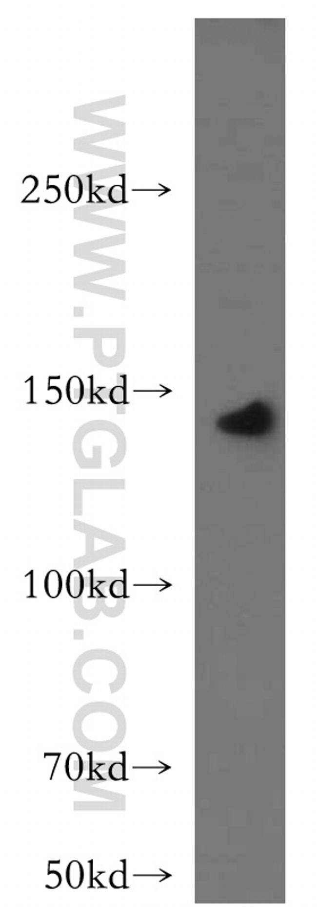 LARS Antibody in Western Blot (WB)