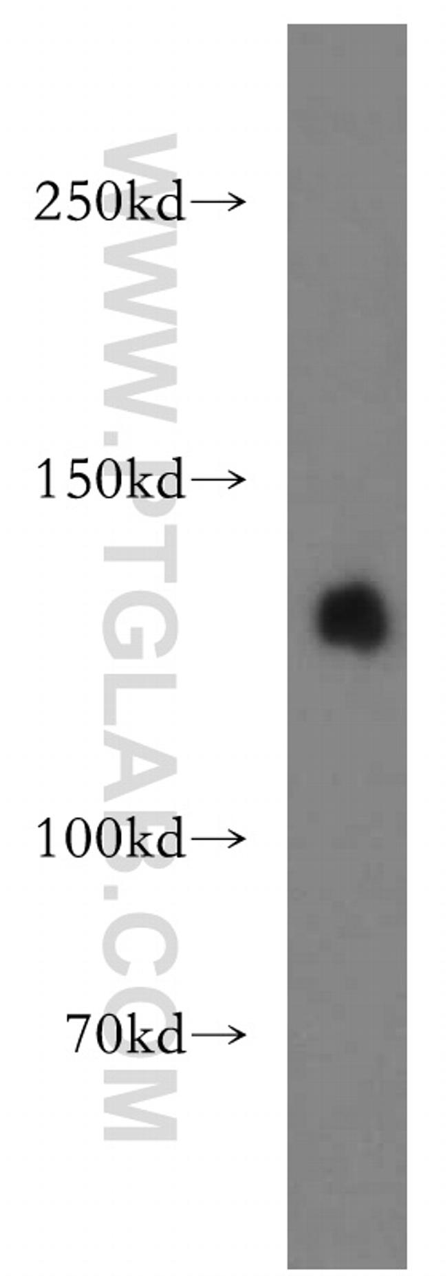 LARS Antibody in Western Blot (WB)