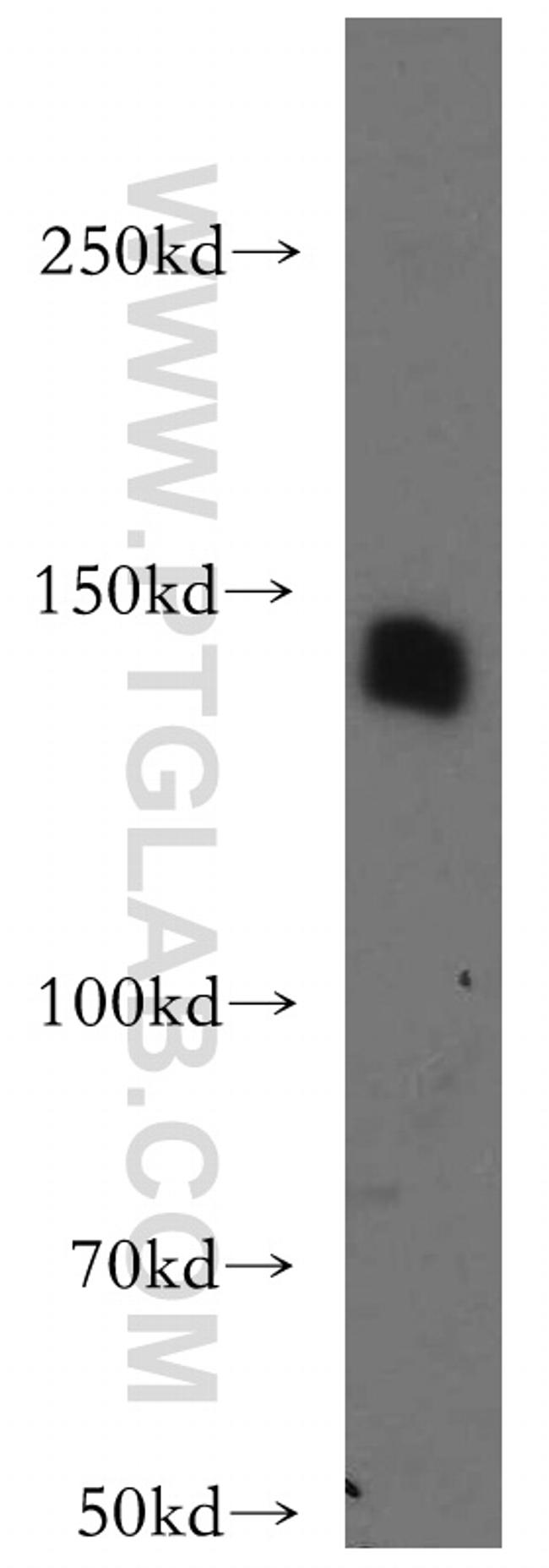 LARS Antibody in Western Blot (WB)