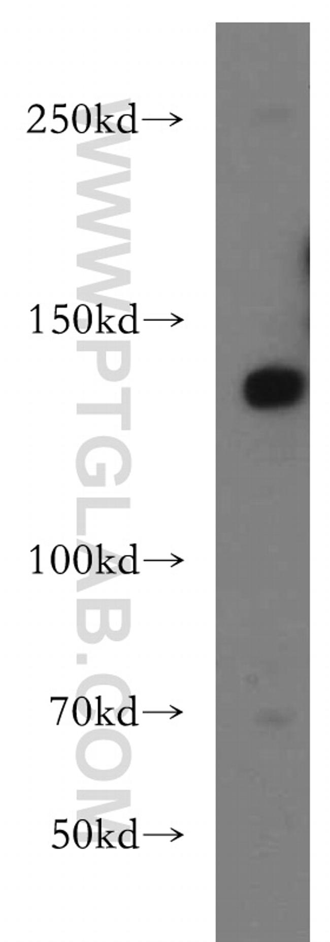 LARS Antibody in Western Blot (WB)