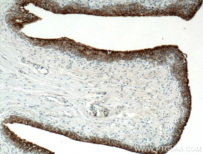 UPK2 Antibody in Immunohistochemistry (Paraffin) (IHC (P))