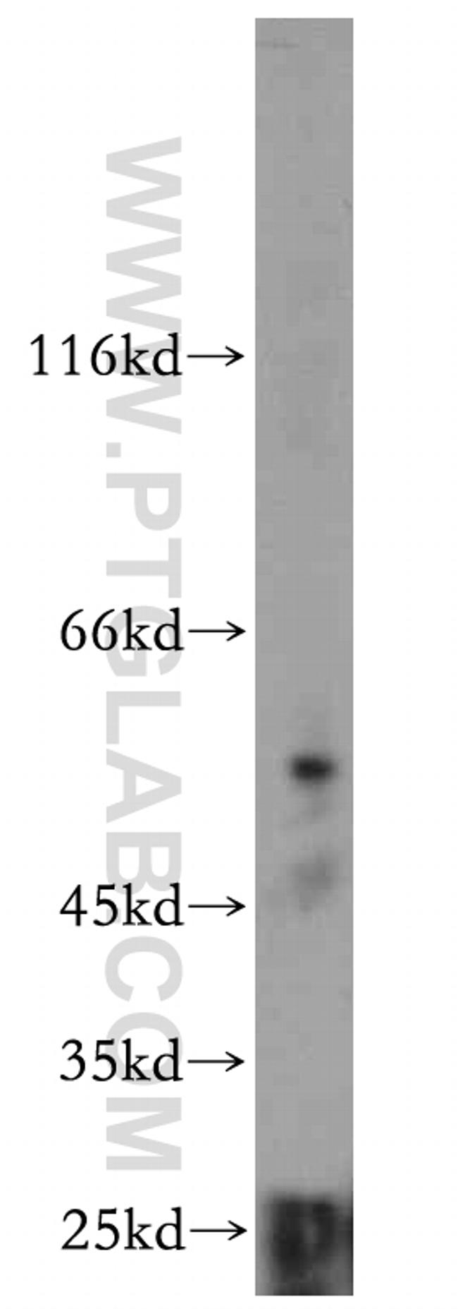 LILRA4 Antibody in Western Blot (WB)