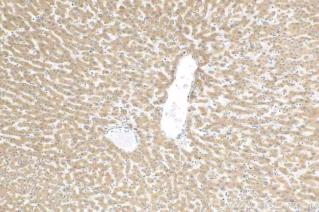 ELOVL6 Antibody in Immunohistochemistry (Paraffin) (IHC (P))