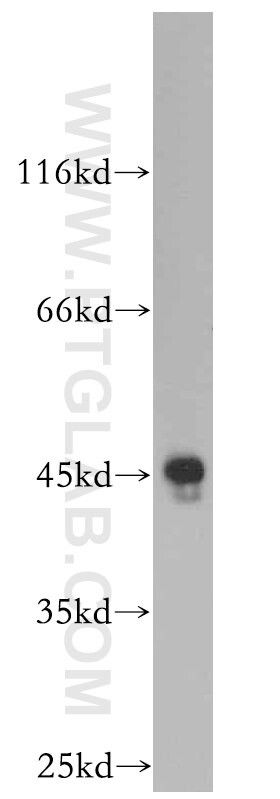 ELOVL6 Antibody in Western Blot (WB)