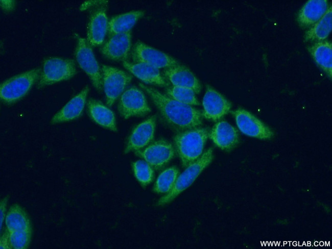 SH3BGR Antibody in Immunocytochemistry (ICC/IF)