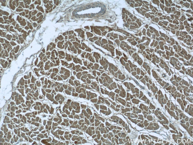 SH3BGR Antibody in Immunohistochemistry (Paraffin) (IHC (P))