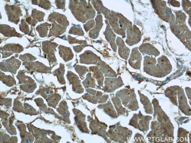 SH3BGR Antibody in Immunohistochemistry (Paraffin) (IHC (P))