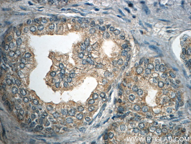 HTR4 Antibody in Immunohistochemistry (Paraffin) (IHC (P))