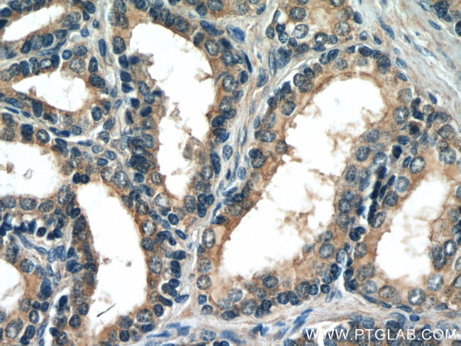 HTR4 Antibody in Immunohistochemistry (Paraffin) (IHC (P))