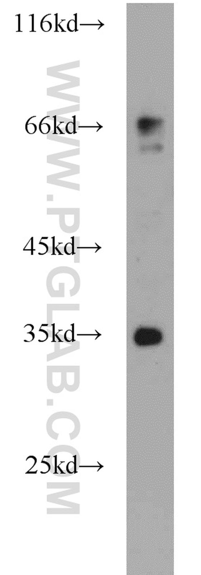 HTR4 Antibody in Western Blot (WB)